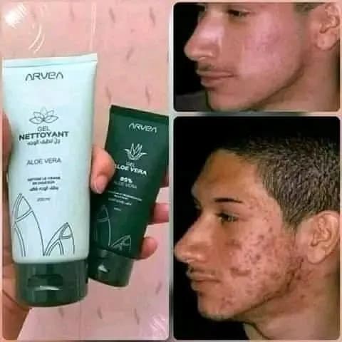 Le produit La crème aloe verra et le gel aloe vera